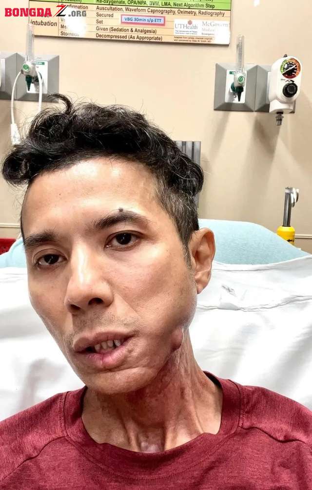 Nhìn Kasim Hoàng Vũ mà thương!